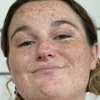 freckledbabyy Desnuda